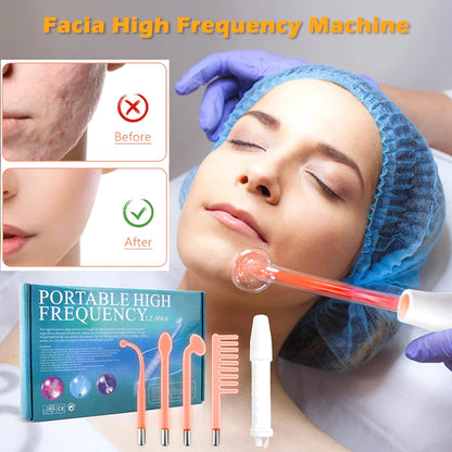 Portable Electrode High Frequency Facial Beauty Machine Electrotherapy Wand Glass Tube Face Cleansing Skin Tightening Device